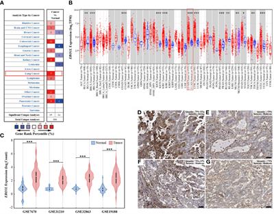 ERO1L Is a Novel and Potential Biomarker in Lung Adenocarcinoma and Shapes the Immune-Suppressive Tumor Microenvironment